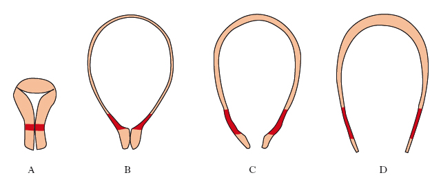 parto nell'Enciclopedia Treccani - Treccani - Treccani