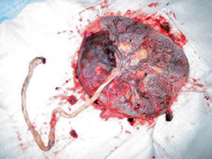 cordone ombelicale e placenta