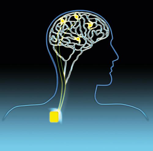 stimolazione cerebrale elettrica e magnetica
