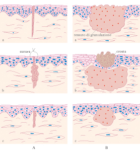 cicatrizzazione