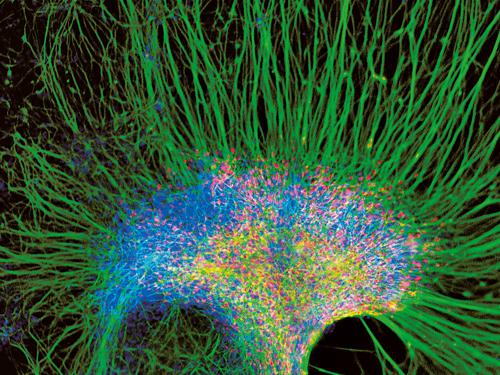 cellule staminali neurali